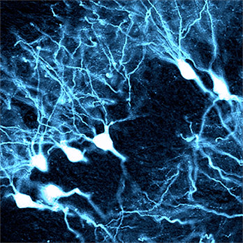 This image shows AAV therapy affecting pyramidal neurons in the hippocampus. (Blake Albright, Asokan Lab)