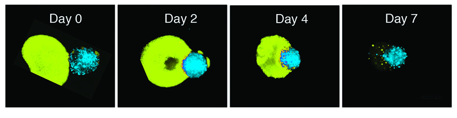 stem cell-tumor images